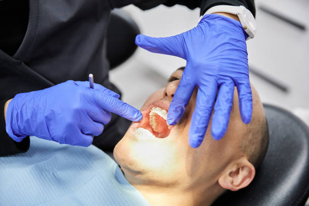 Best Lost Filling or Crown Replacement in Momence, IL